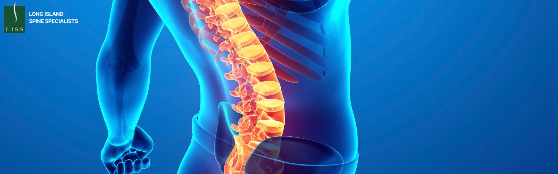 Injuries of the Thoracolumbar Spine